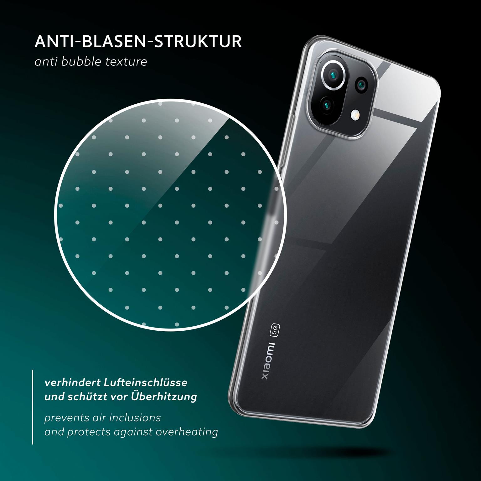 moex Aero Case Xiaomi Mi 11 Lite durchsichtig aus Silikon – Weiteres Produktbild 6