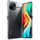 moex Aero Case Xiaomi Mi 11 Lite 5G durchsichtig aus Silikon – Weiteres Produktbild 1